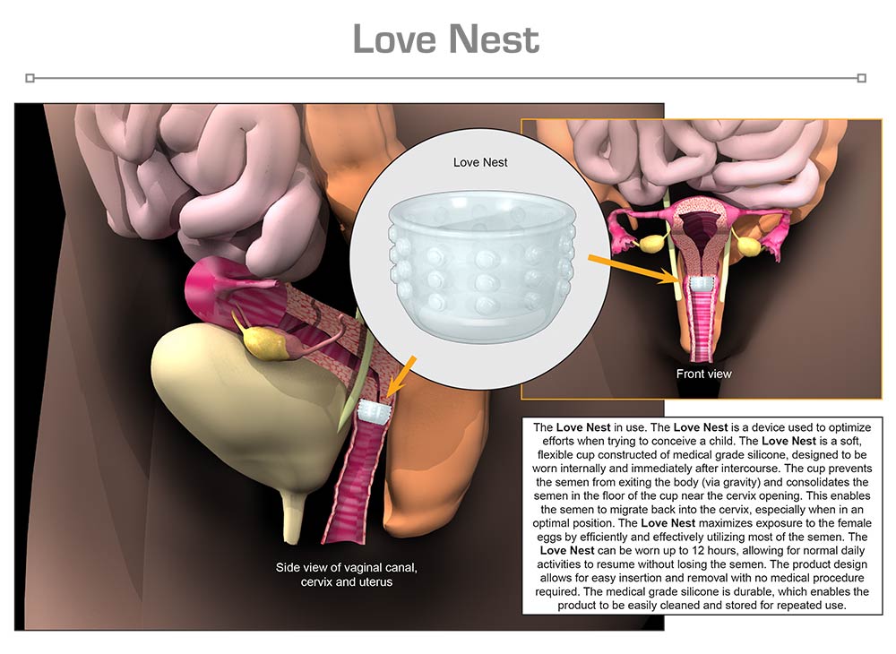 Love Nest